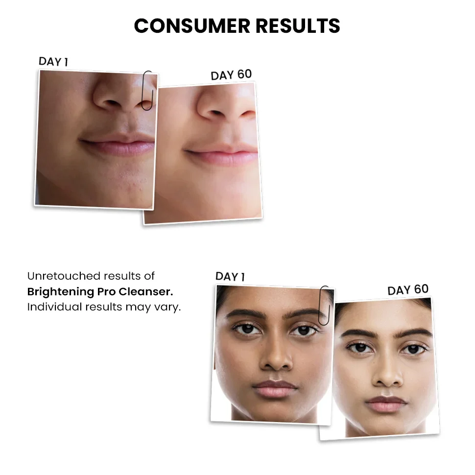Brightening PRO Cleanser For Women, 100 ml - Image 6