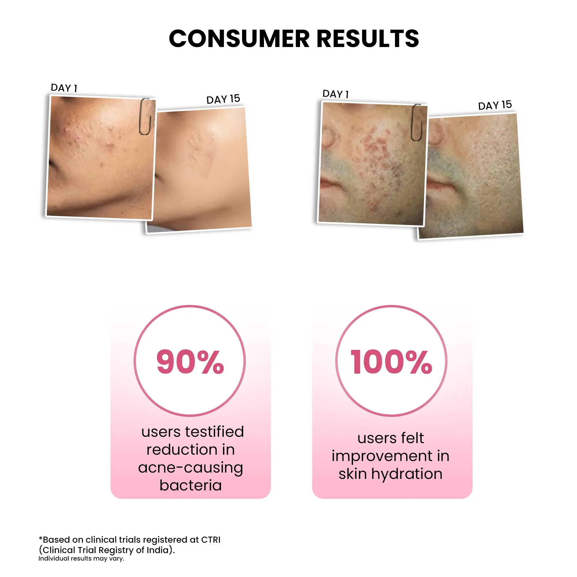 Goodbye Acne Trial Kit - Image 7