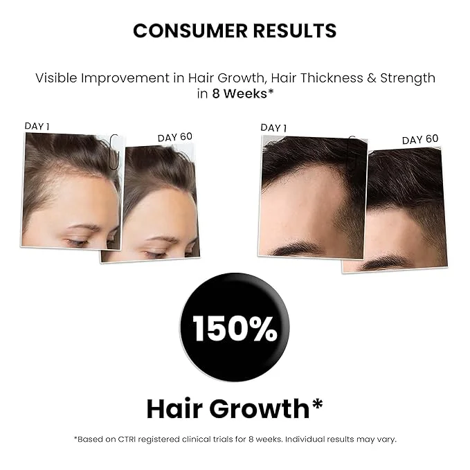 Hair Growth Serum, 2.0 - Roll On, 10ml - Image 5