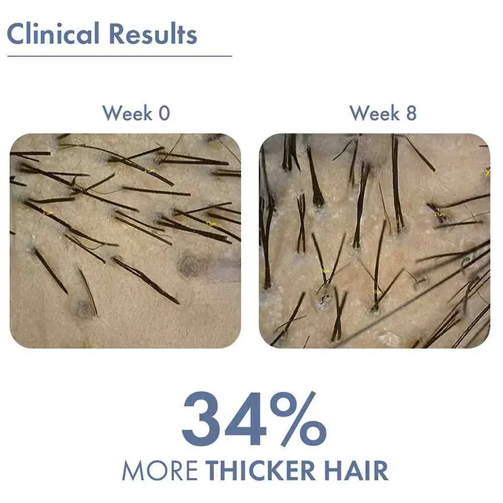 Hair Growth Serum 2.0 For Men & Women - Image 10