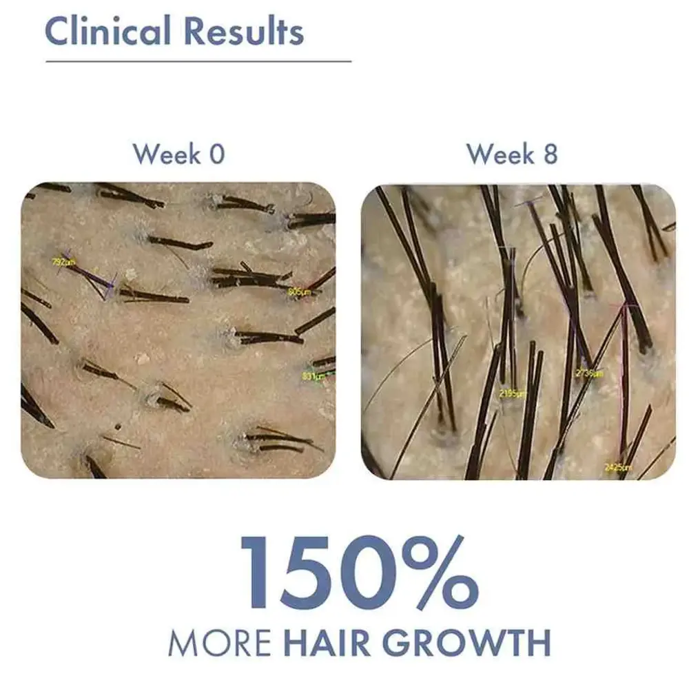 Hair Growth Serum 2.0 For Men & Women - Image 6