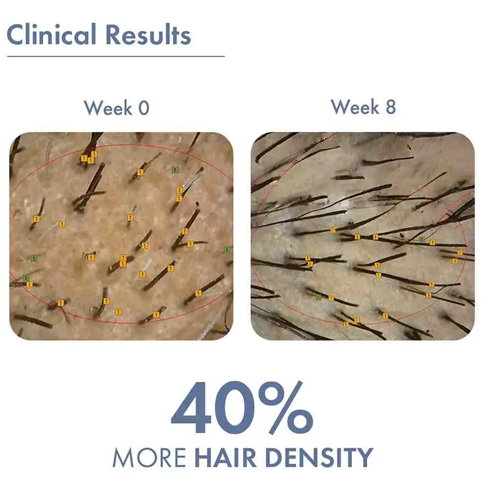 Hair Growth Serum 2.0 For Men & Women. - Image 7