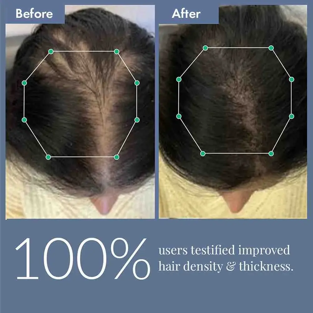 Hair Growth Serum 2.0 For Men & Women. - Image 8