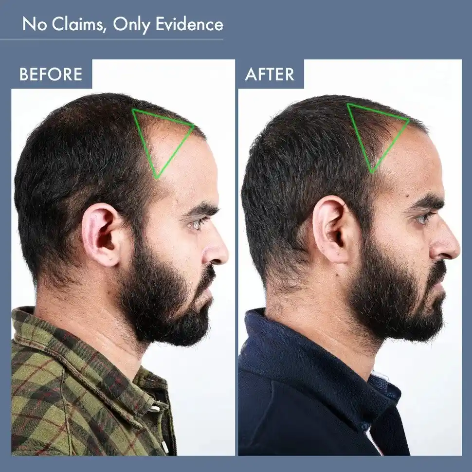 Men’s Hair Growth Solution with DHT Blocker - Image 8