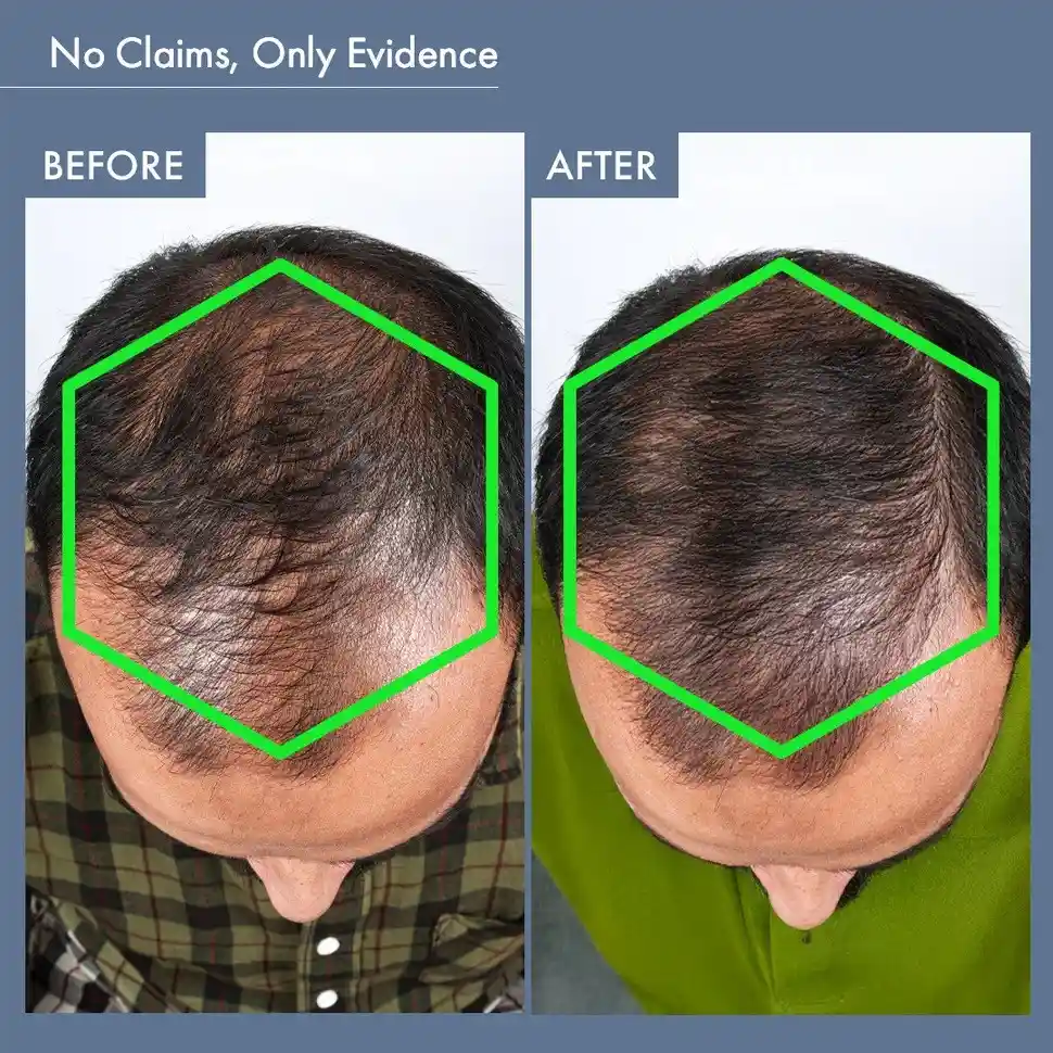 Men’s Hair Growth Solution with DHT Blocker - Image 9