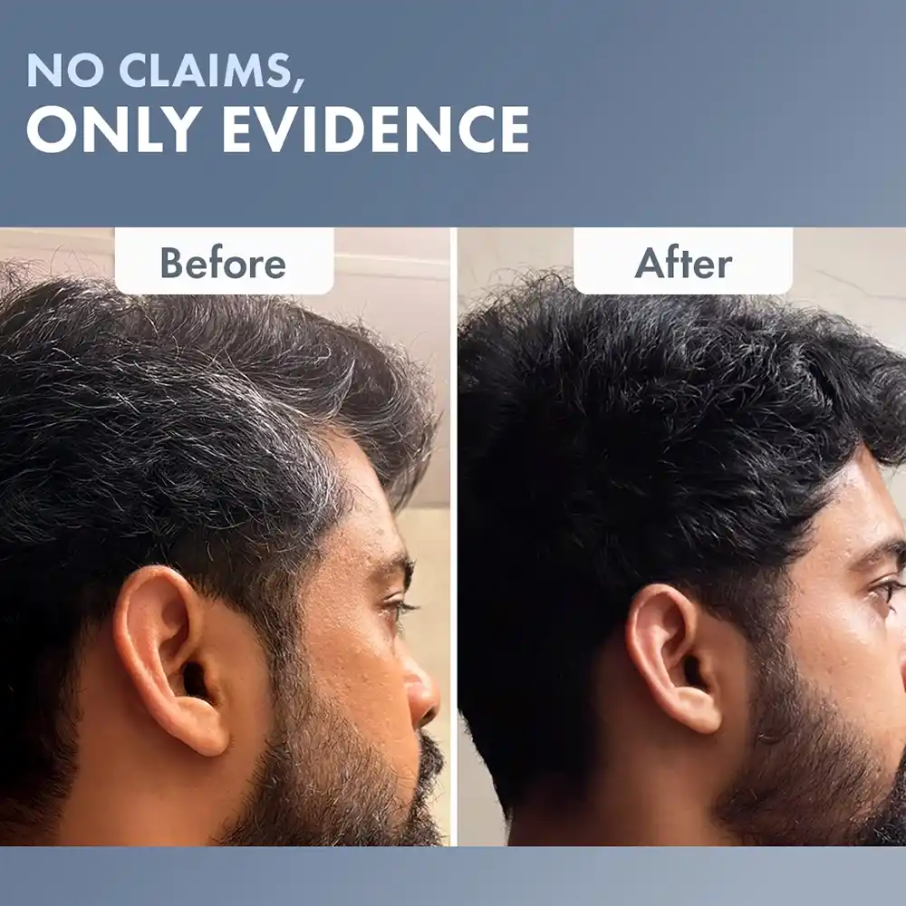 Permanent Hair Color Creme for Men, 70 ml - Image 6