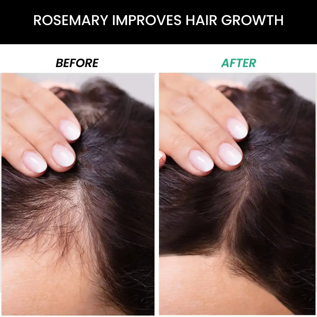 Anti Hair Fall Control Kit: Rosemary Shampoo, Conditioner, Essential Oil, Water - Image 3