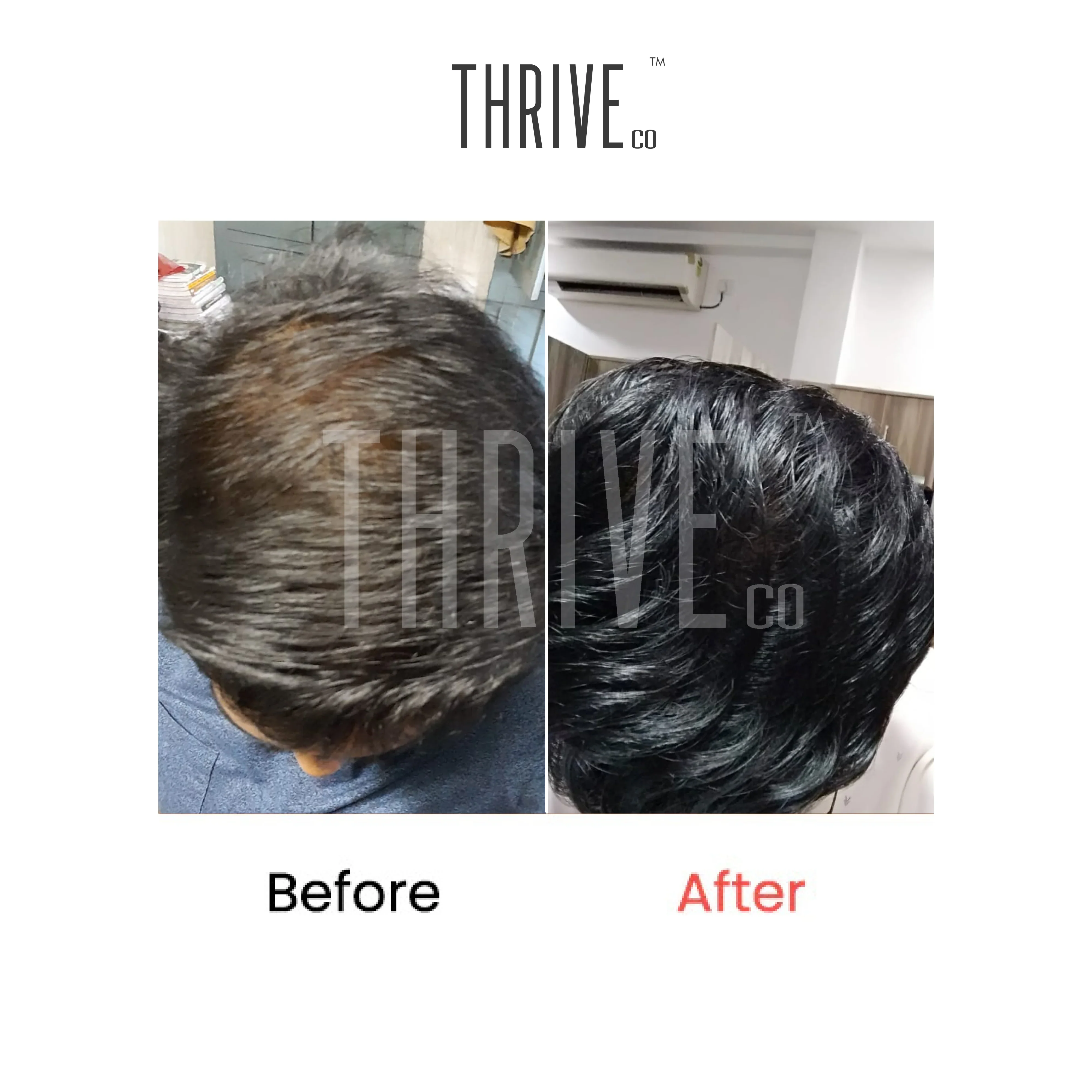 Hair Growth Serum (50ml) + Scalp Exfoliating Scrub (100ml) - Image 3