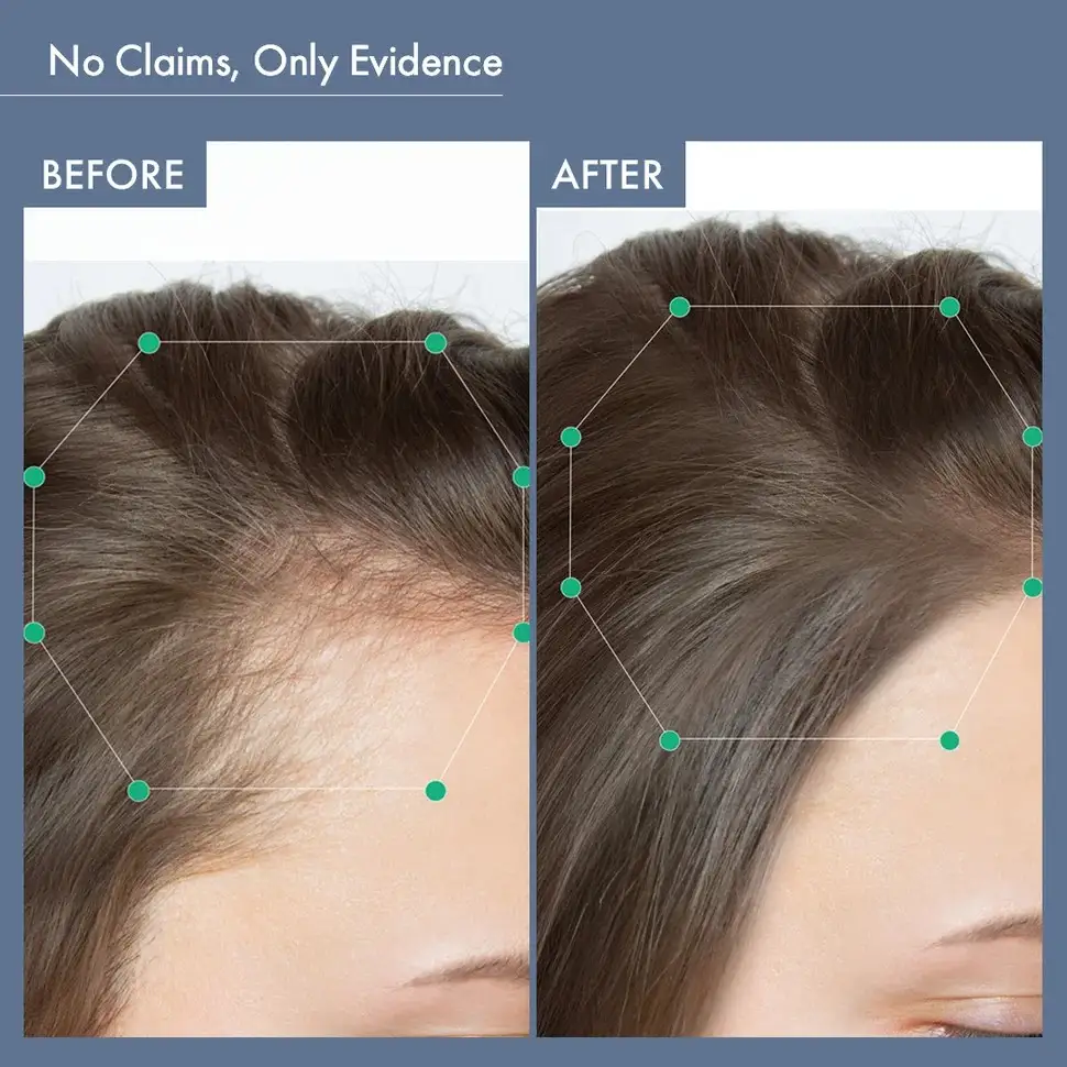Women’s Balance Hair Growth Solution - Image 7
