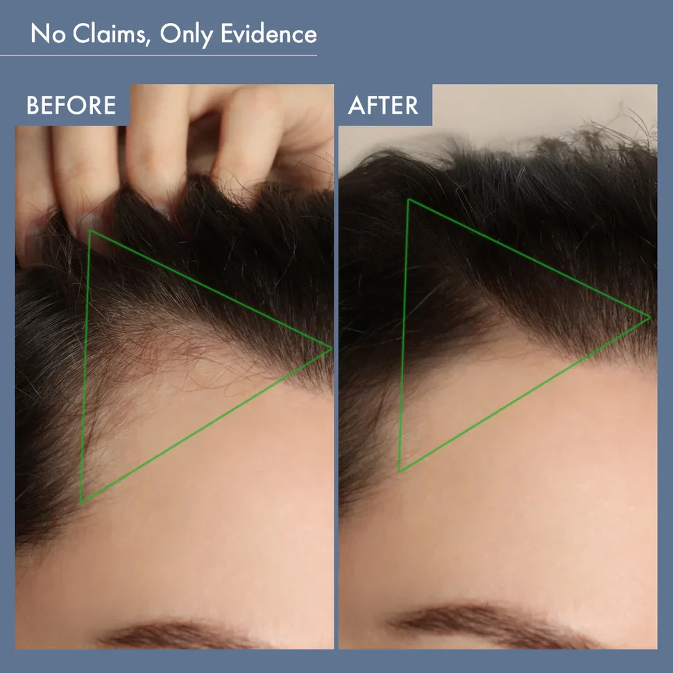Women’s Hair Growth Solution - Image 8