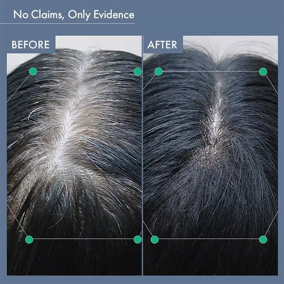 Women’s Post-Partum Hair Growth Solution - Image 8